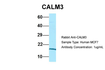 CALM3 Rabbit Polyclonal Antibody