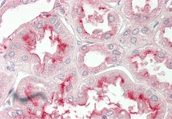 LGR5 Rabbit Polyclonal Antibody