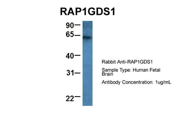 RAP1GDS1 Rabbit Polyclonal Antibody
