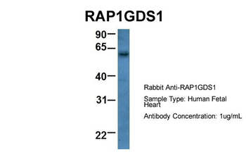 RAP1GDS1 Rabbit Polyclonal Antibody