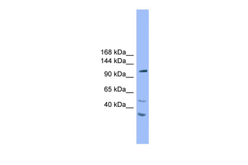 STARD8 Rabbit Polyclonal Antibody