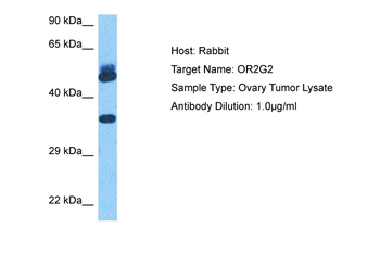 OR2G2 Rabbit Polyclonal Antibody