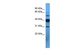 OR2T1 Rabbit Polyclonal Antibody