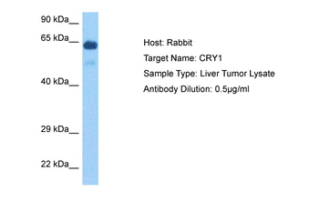 CRY1 Rabbit Polyclonal Antibody