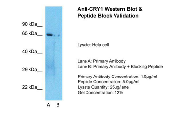 CRY1 Rabbit Polyclonal Antibody