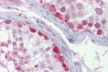 CRY1 Rabbit Polyclonal Antibody