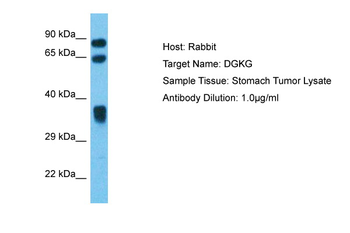 DGKG Rabbit Polyclonal Antibody