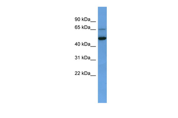 IQCB1 Rabbit Polyclonal Antibody