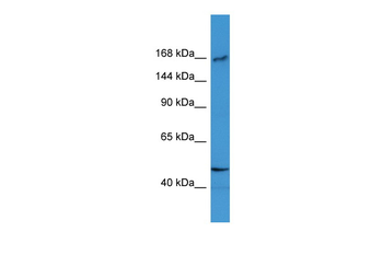 BTBD12 Rabbit Polyclonal Antibody
