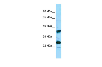 MRGPRX4 Rabbit Polyclonal Antibody