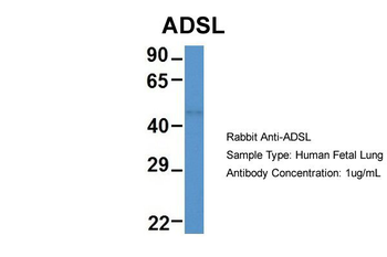 ADSL Rabbit Polyclonal Antibody