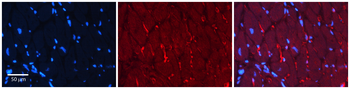 ADSL Rabbit Polyclonal Antibody