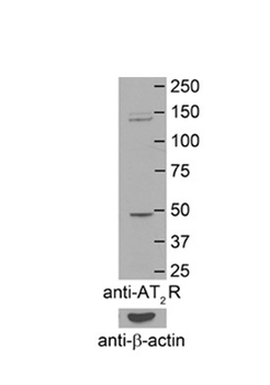 AGTR2 Rabbit Polyclonal Antibody