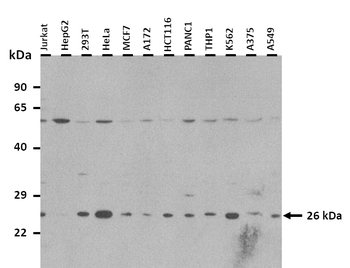 C1QA Rabbit Polyclonal Antibody