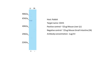 CDH5 Rabbit Polyclonal Antibody