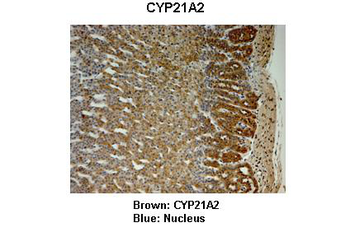 CYP21A2 Rabbit Polyclonal Antibody
