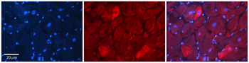 DAP Rabbit Polyclonal Antibody