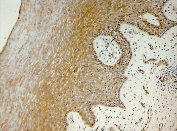 AKR1C1 Rabbit Polyclonal Antibody