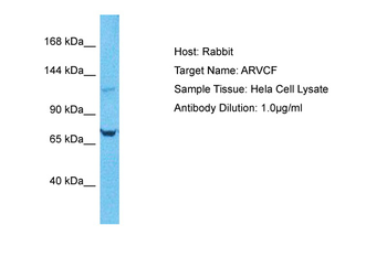 ARVCF Rabbit Polyclonal Antibody