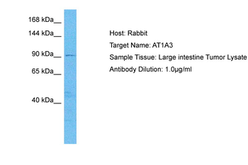 ATP1A3 Rabbit Polyclonal Antibody