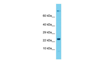 Dctn5 Rabbit Polyclonal Antibody