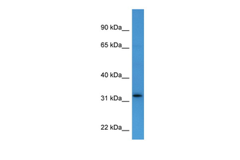 DOK4 Rabbit Polyclonal Antibody