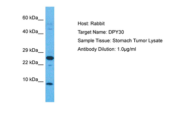DPY30 Rabbit Polyclonal Antibody