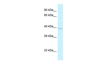 GPR174 Rabbit Polyclonal Antibody