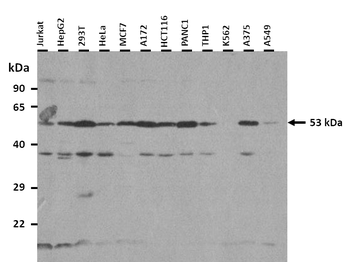 LPL Rabbit Polyclonal Antibody