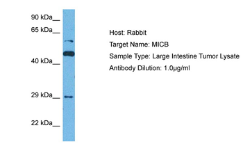 MICB Rabbit Polyclonal Antibody
