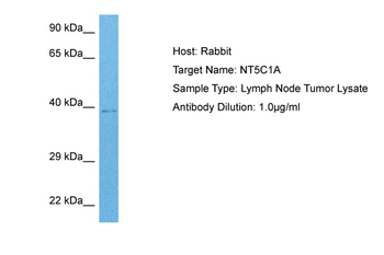 NT5C1A Rabbit Polyclonal Antibody