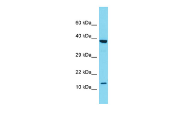 SCGB2A1 Rabbit Polyclonal Antibody