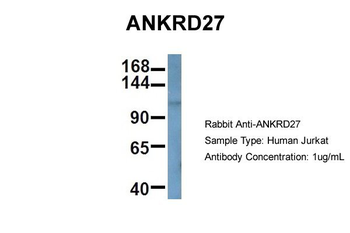 ANKRD27 Rabbit Polyclonal Antibody