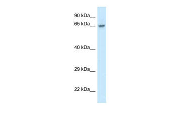 FAM161A Rabbit Polyclonal Antibody