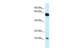 NICN1 Rabbit Polyclonal Antibody