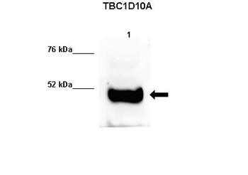 TBC1D10A Rabbit Polyclonal Antibody
