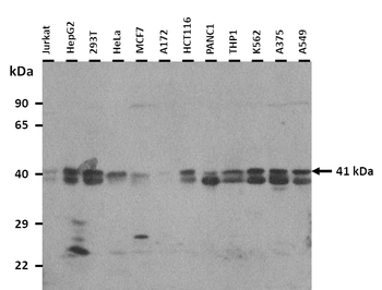 ATAD1 Rabbit Polyclonal Antibody