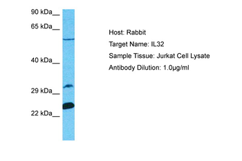 IL32 Rabbit Polyclonal Antibody