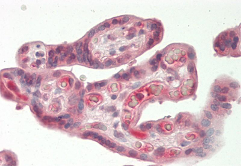 HPSE Rabbit Polyclonal Antibody