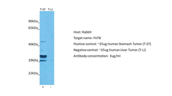 FUT8 Rabbit Polyclonal Antibody