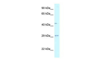FUT8 Rabbit Polyclonal Antibody