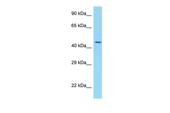 ADIPOR2 Rabbit Polyclonal Antibody