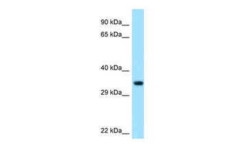 PECR Rabbit Polyclonal Antibody