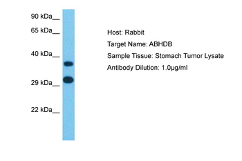 ABHD11 Rabbit Polyclonal Antibody
