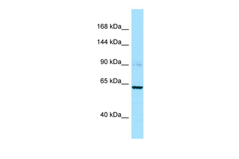 CAPN3 Rabbit Polyclonal Antibody