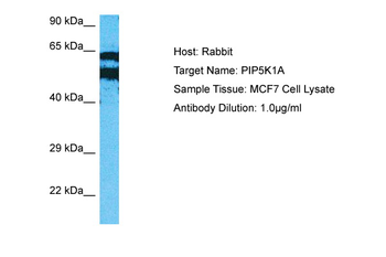 PIP5K1A Rabbit Polyclonal Antibody