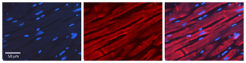 ACTA1 Rabbit Polyclonal Antibody