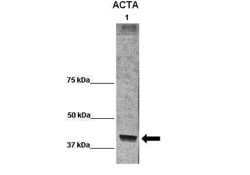 ACTA1 Rabbit Polyclonal Antibody