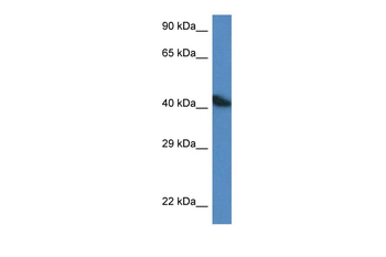 ACTA1 Rabbit Polyclonal Antibody