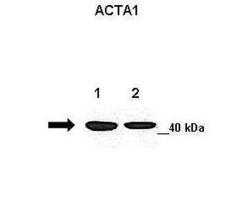 ACTA1 Rabbit Polyclonal Antibody